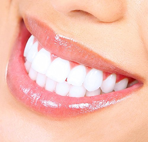 Комплет за белење на забите од Дентавит - Комплетен комплет за белење од почеток до крај - оставете ја вашата насмевка да искра