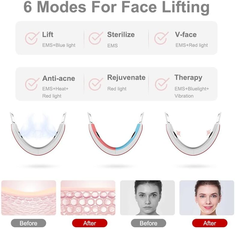 Масажарот за масажер за кревање на лицето за подигнување на лицето LED лесна терапија со двојно брада против образот за слабеење на вибрации