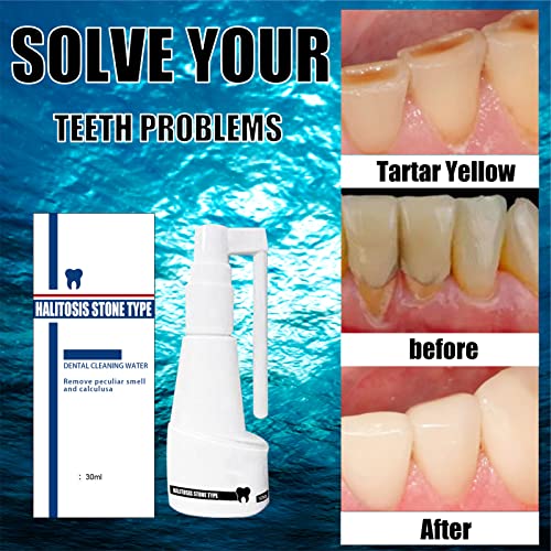 Спреј за стоматолошки пресметки, спреј за отстранување на заби за заби безбеден 30 ml блага долготрајна орална нега за дневна