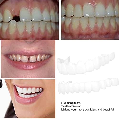 Заби за заби, прилагодливи привремени совршени лажни заби калапи загради ， деформитети исфрлени заби покриени со убав изглед