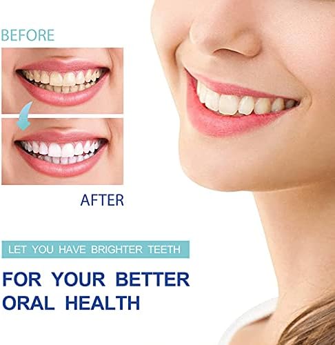 Комплет за белење на заби за сензори со LED светло за забрзување, 35% карбамид пероксид заби за заб, тајмер уред и фиока за силиконски уста,