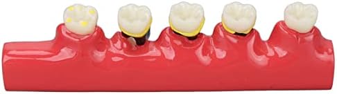 Модел на стоматолошка болест, Стоматолошка патологија Цврст образовен модел за стоматолошки универзитети