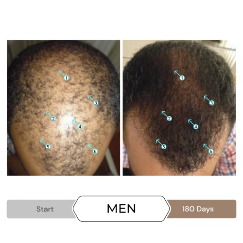 Revita Shampoo и Spectral.dnc-N пакет за поддршка на растот на косата