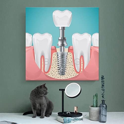 Блудуг Стоматолошка Болница Постер Стоматолошки Имплант Постер Стоматолошки Платно Сликарство Постери И Отпечатоци Ѕидни Уметнички Слики За