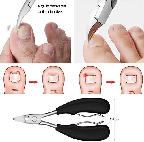 Ножици за нокти-Професионален Третман На Вродени Нокти, Нокти За Нокти За Постари Дебели Нокти, Надградени Нокти За Нокти За Мажи,