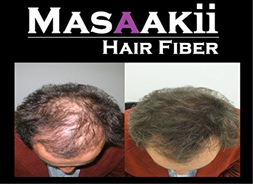 Масакии Влакна за Коса 0,87 мл/25гр-брз третман За губење на косата Канада