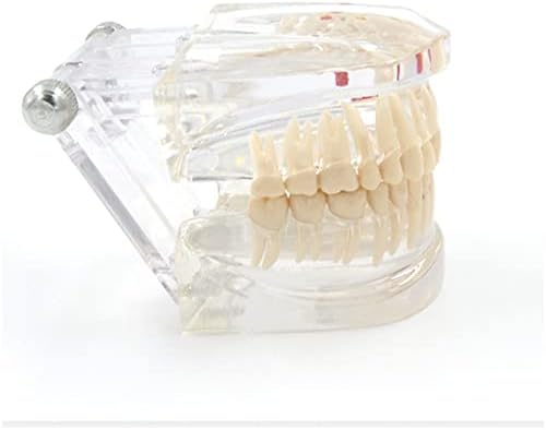 KH66ZKY Транспарентен постојан модел на патологија на забите Сеопфатен патолошки стоматолошки модел за стоматолошка студија