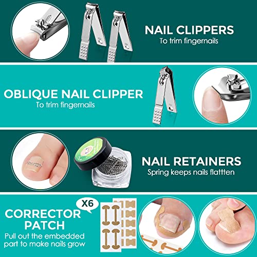 Третман со вграден нокти, клипери за нокти поставени за густа и вкоренета алатка за професионална педикир, коректор на нокти на ноктите, лепенка за корекција на нок