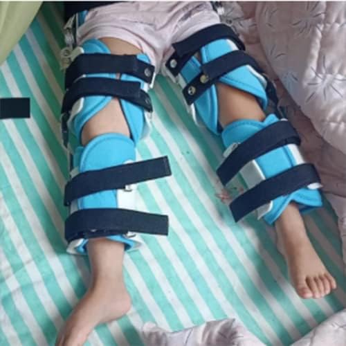 Детето киднапирање на колкот Ортоза Детска дислокација на зглобот на колкот на детски заграда за киднапирање на колкот за заграда
