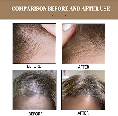 TMTW ориз анти-пад шампон сапун за раст на косата, сув оштетен сапун за поправка на косата за слабеење на косата и губење на косата